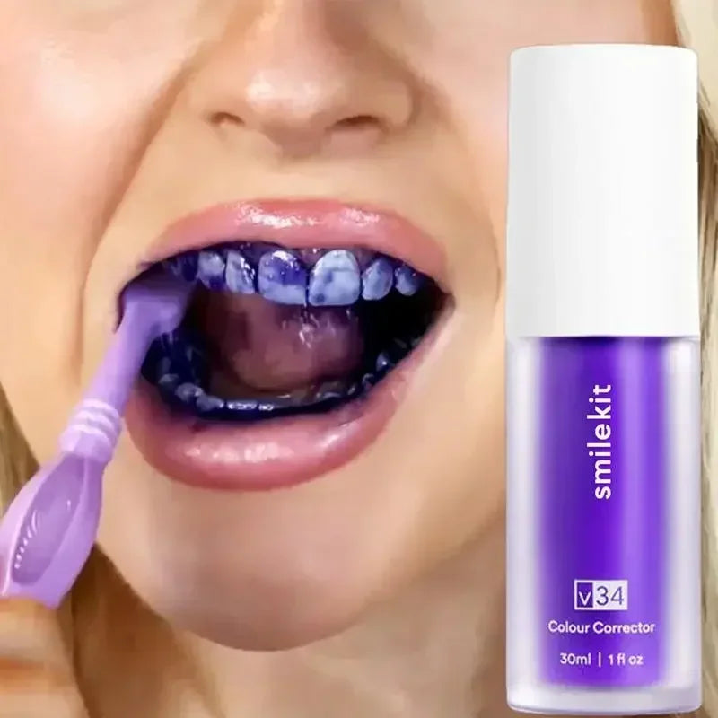®SmileEase - משחה מלבינה